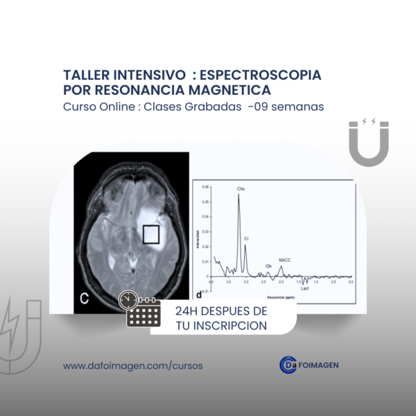 Espectroscopia por resonancia magnética