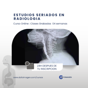 Estudios Seriados en Radiología